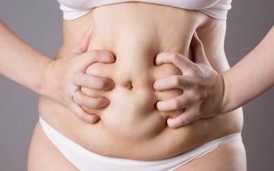 Tightening Loose Skin After Weight Loss