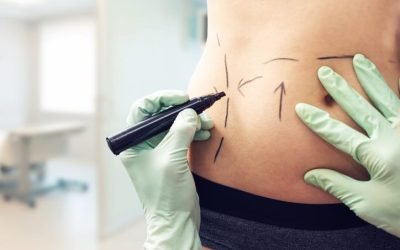 Cosmetic Surgery Vs Plastic Surgery: What is the Difference?