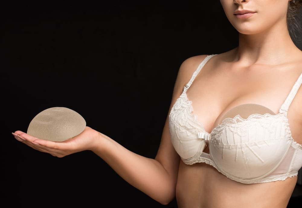 how long do breast implants last