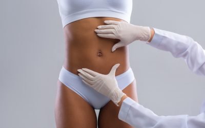 How Much Weight Can You Lose with Liposuction?