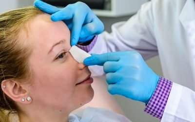 Rhinoplasty Swelling and Healing Stages Timeline