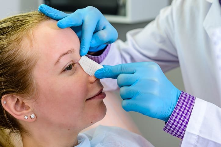 Rhinoplasty Swelling and Healing Stages Timeline