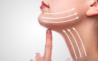How to Get Rid of Turkey Neck