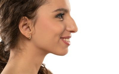 Should I Get a Nose-Job (Rhinoplasty)?
