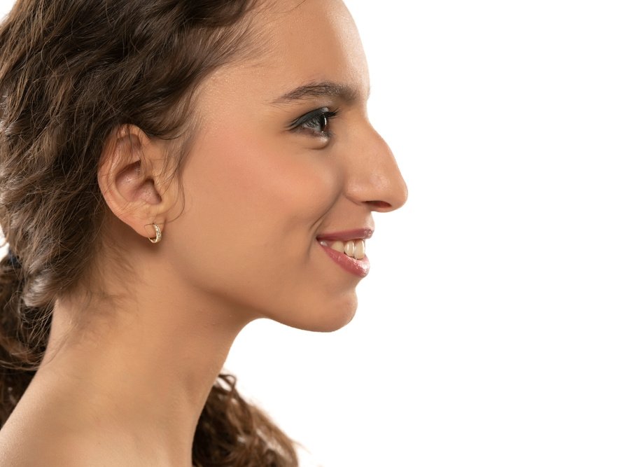 Should I Get a Nose-Job (Rhinoplasty)?