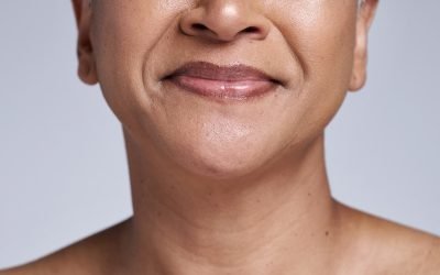 How to Get Rid of Saggy Cheeks