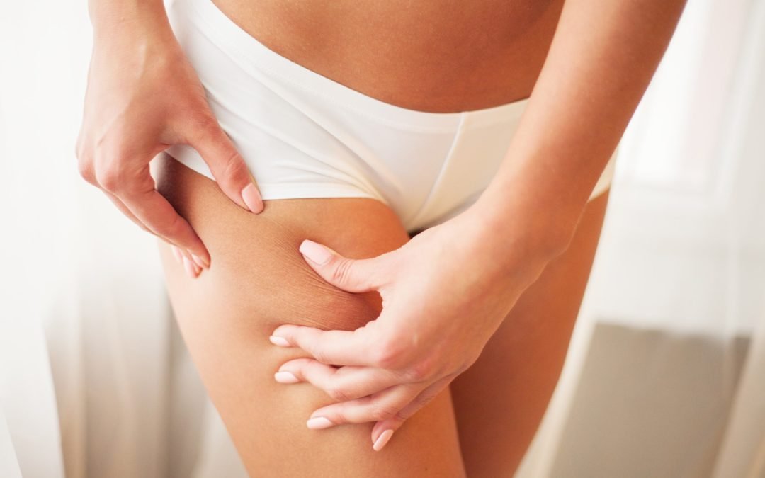 How to Tighten Loose Thigh Skin