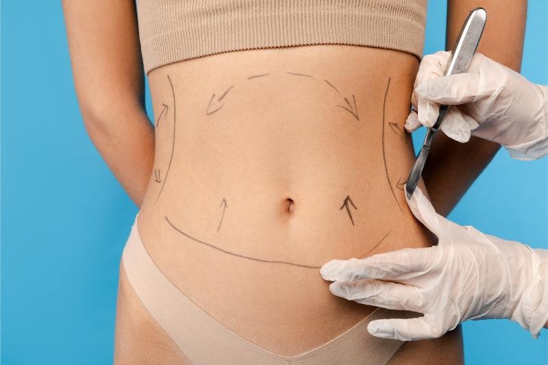 close up of plastic surgeon using marker pen while 2025 02 20 09 23 44 utc close up of plastic surgeon using marker pen while 2025 02 20 09 23 44 utc