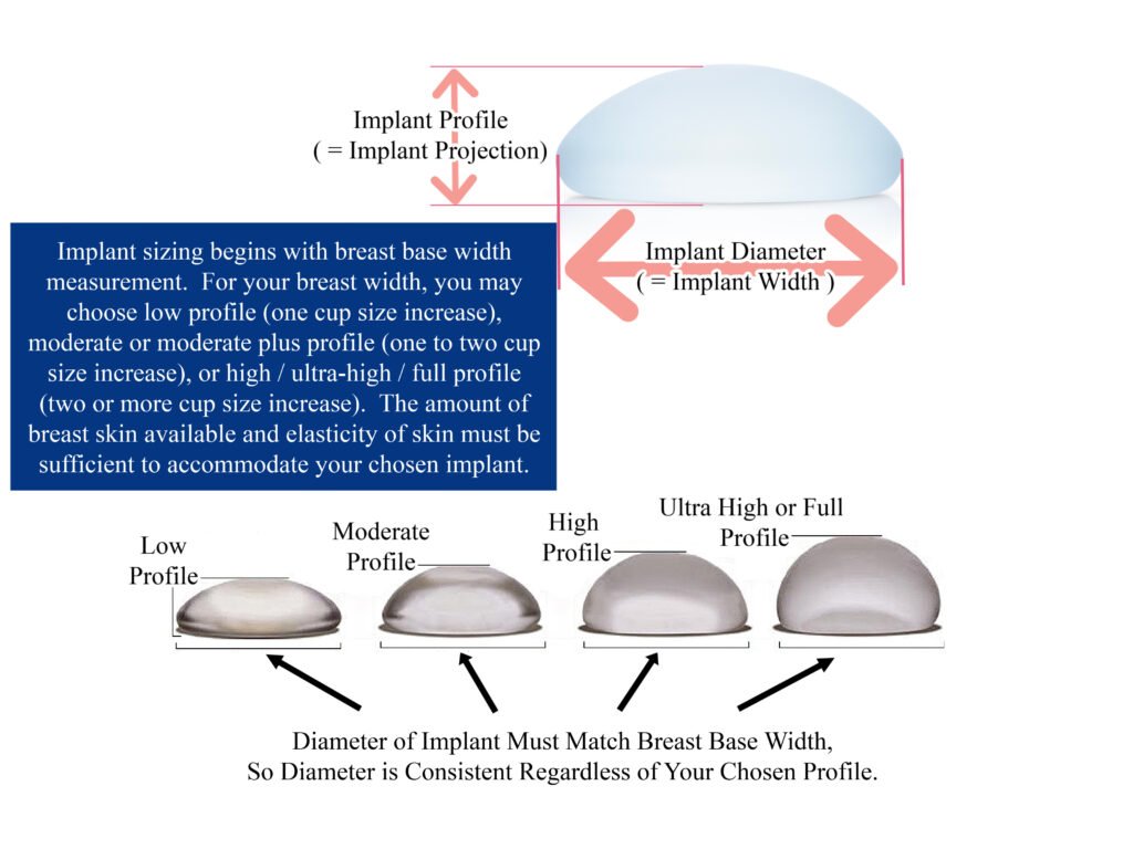 Breast Implant Sizing How to Choose Breast Implant Size Breast Implant Profile 1024x768 Breast Implant Sizing How to Choose Breast Implant Size Breast Implant Profile 1024x768