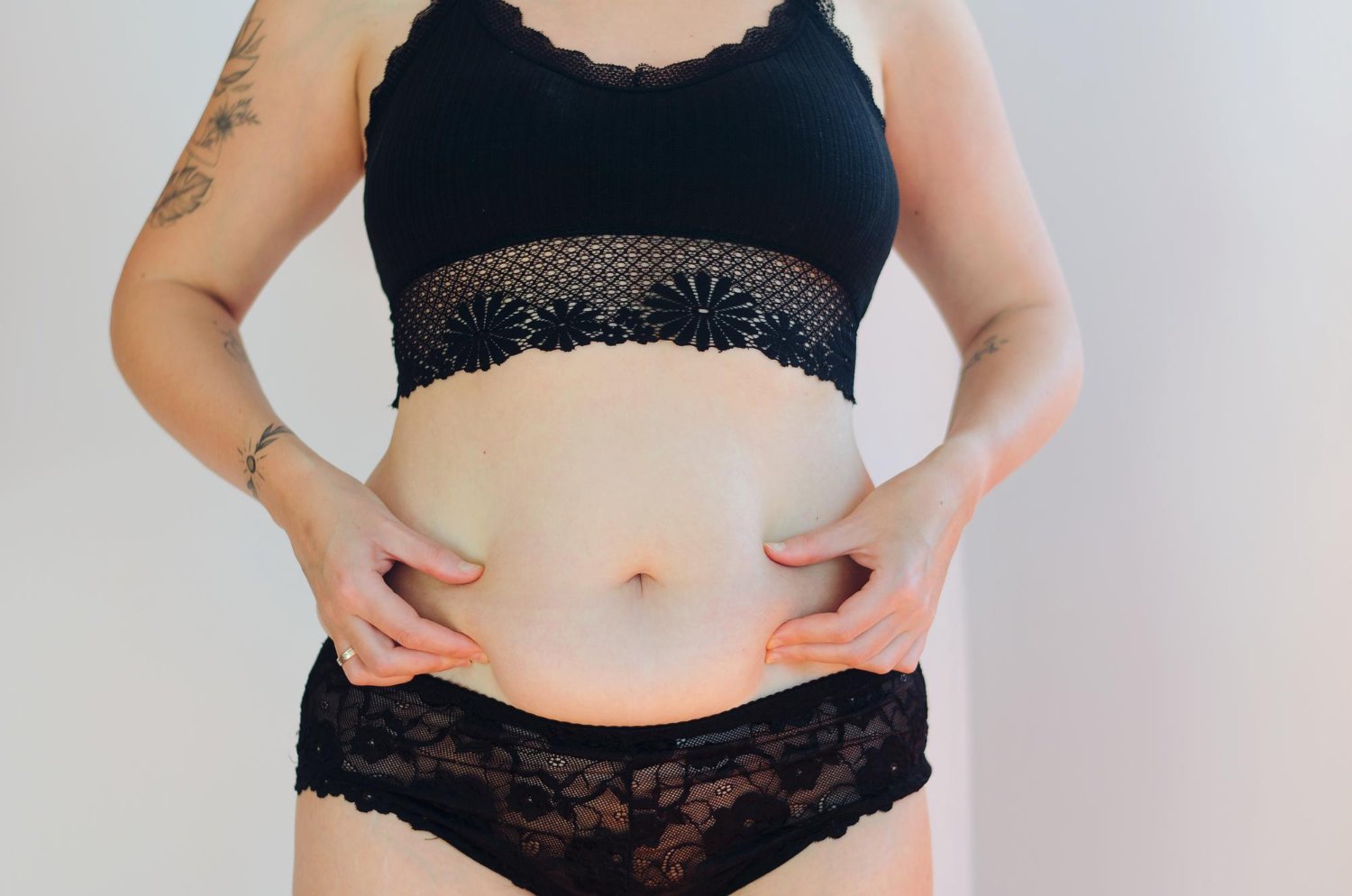 mommy makeover mommy makeover
