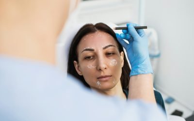 Understanding San Diego Face Lift Techniques for Natural Results