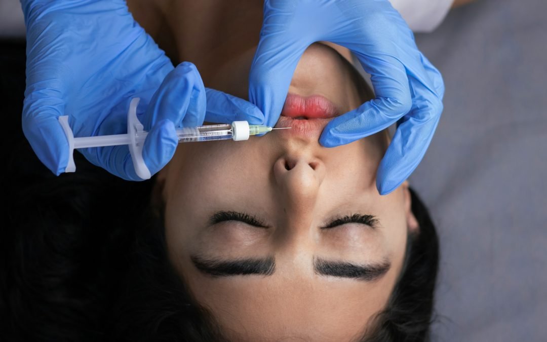 How Long Should You Wait Between Cosmetic Procedures in Rancho Santa Fe