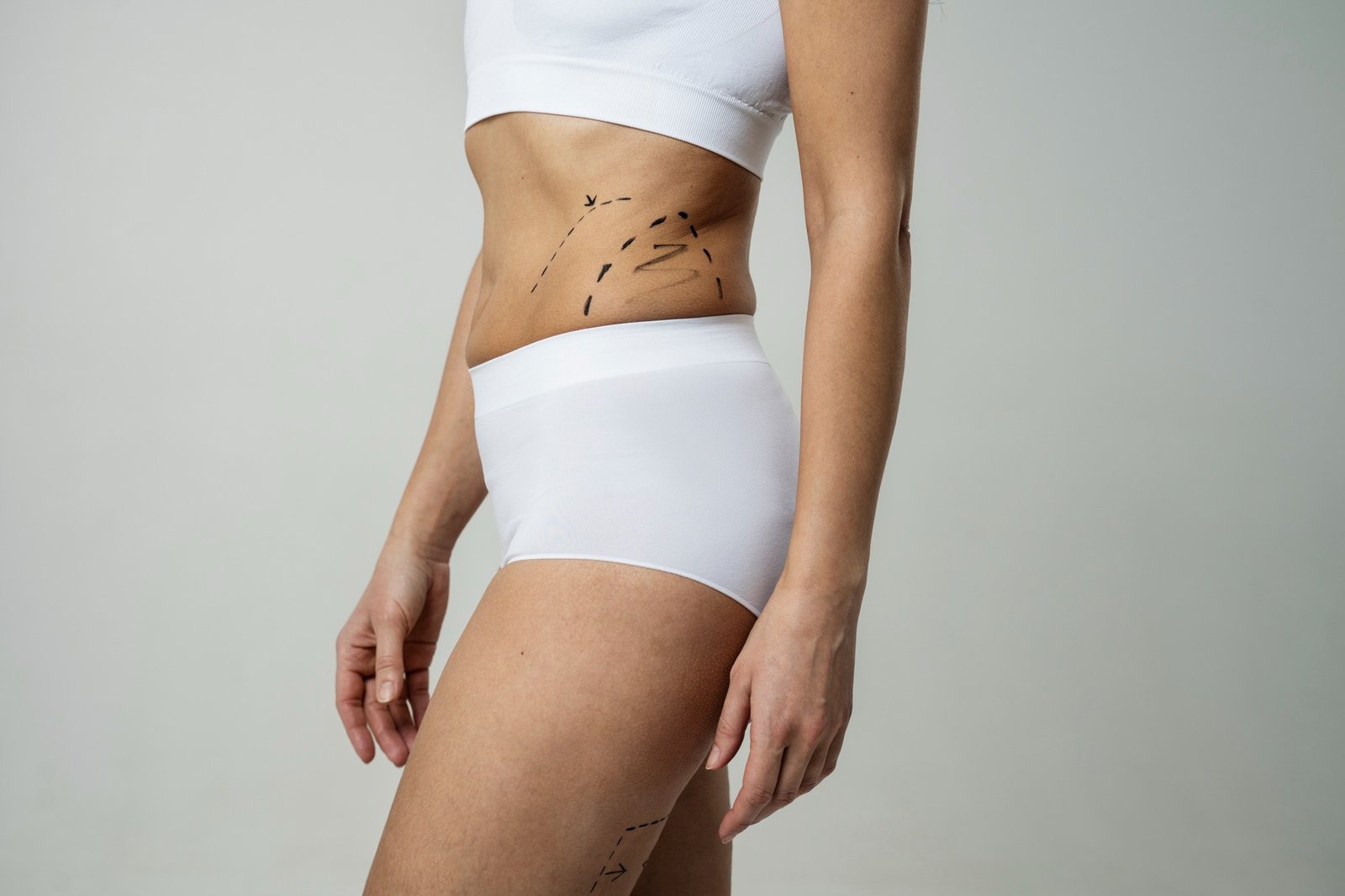 tummy tuck tummy tuck