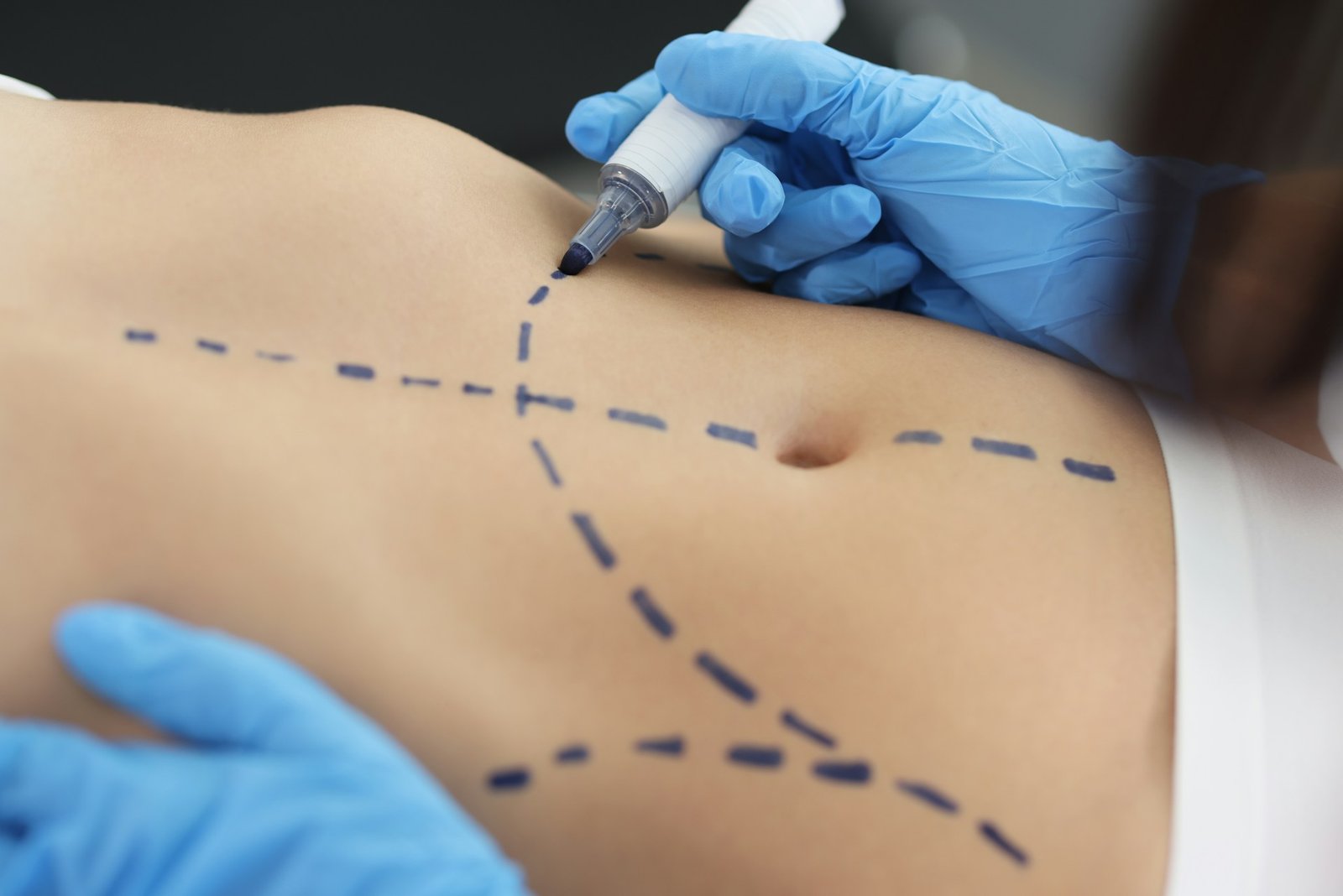 Body Procedures