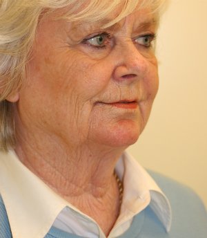 Neck and Lower Face Re-shaping - before - oblique