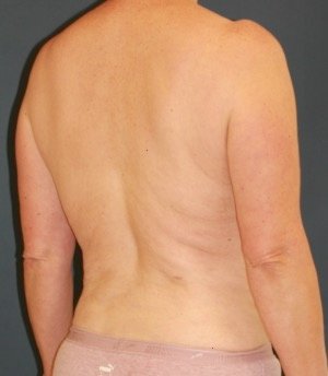 Waist to Butt 1 - after - oblique
