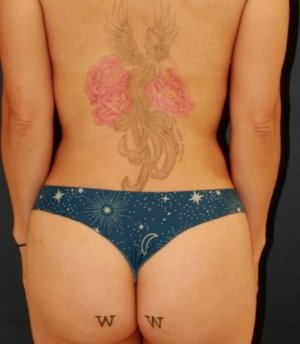 Waist to Butt 6 - after - front