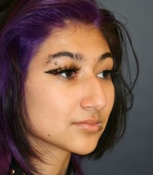 Rhinoplasty 218 - before - left side