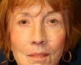 Lips and Skin Rx - after