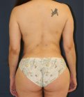 Waist to Butt 2 - after