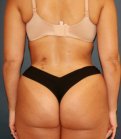 Waist to Butt 4 - after