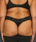 Waist to Butt 8 - before
